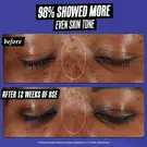 before & after on dark skin: 98% showed more even skin tone 