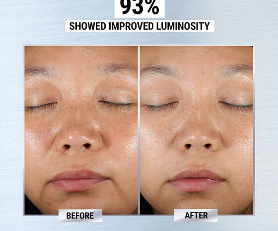 Clearly Corrective Dark Spot Solution Dark Spot Corrector Kiehl S Clearly Corrective Dark Spot Solution Dark Spot Corrector Kiehl S