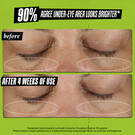 before & after 90% agree under eye area looks brighter*