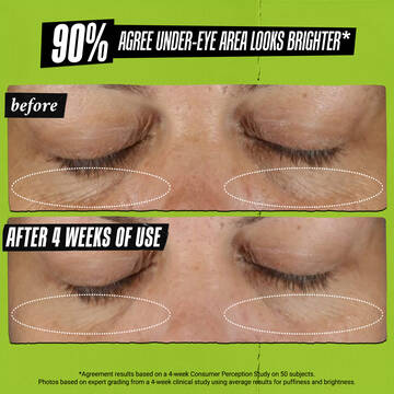 before & after 90% agree under eye area looks brighter*