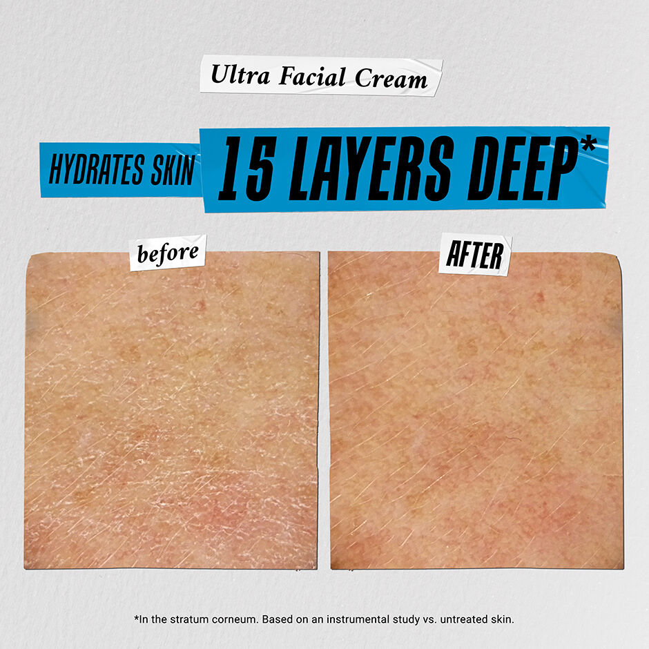 The Hydration Refill Gift Set before and after