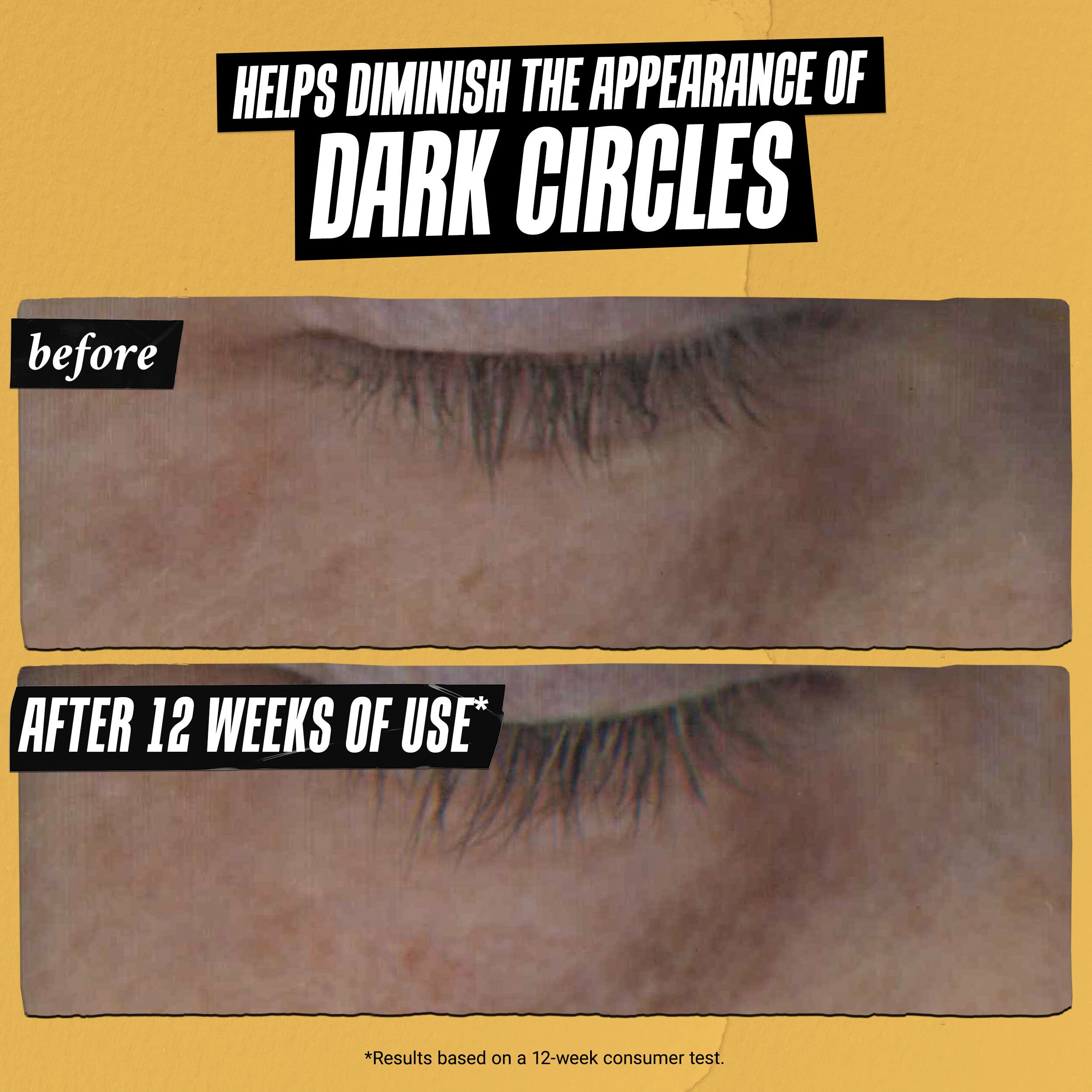 Powerful-Strength Dark Circle-Reducing Vitamin C Eye Serum