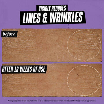 before & after of wrinkles: visibly reduces lines & wrinkles after 12 weeks of use