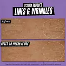 before & after of wrinkles: visibly reduces lines & wrinkles after 12 weeks of use