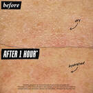 ufc-before-after