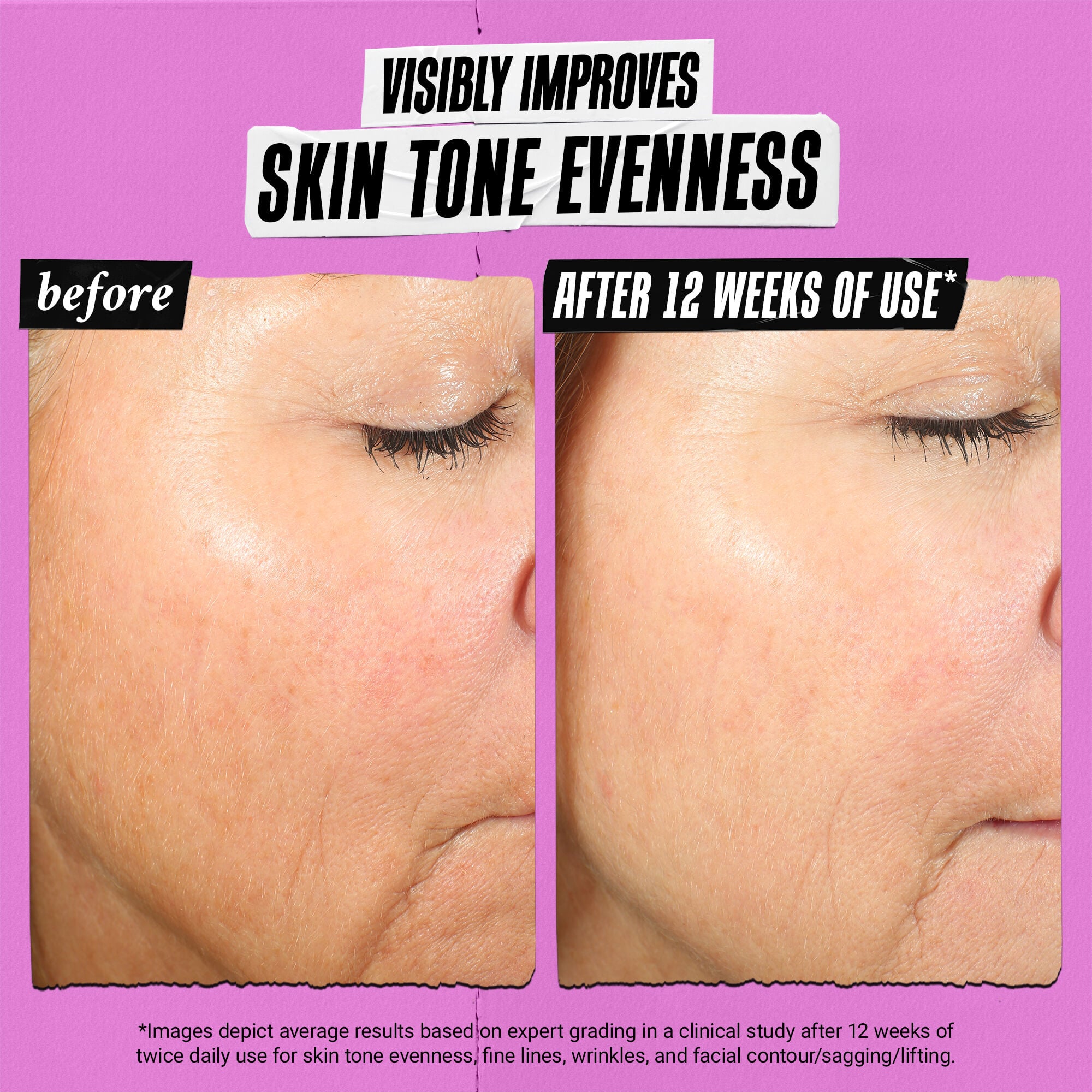 Super Multi-Corrective Anti-Aging Cream for Face and Neck