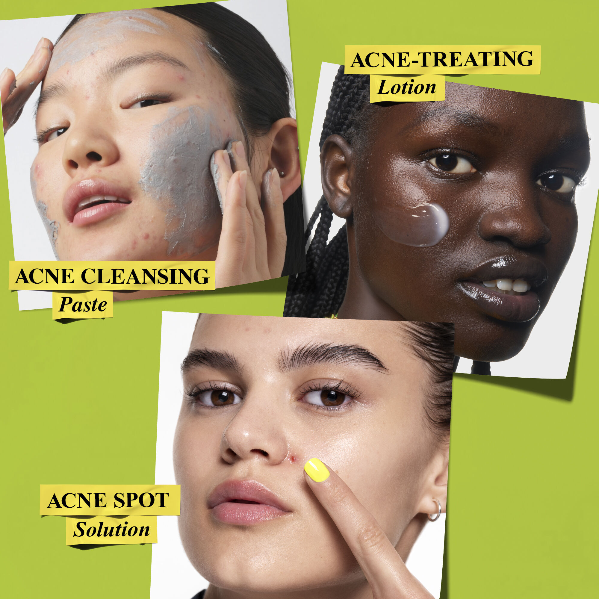 Clear Intentions Acne Set