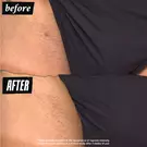 Ingrown Hair and Tone-Correcting Intimate Drops