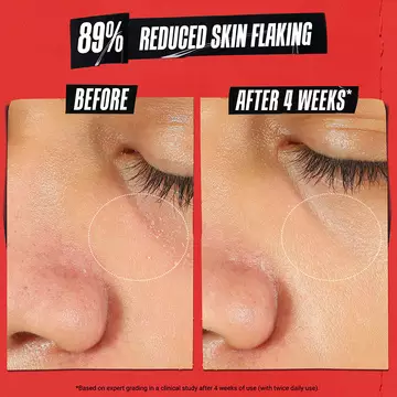 Ultra Facial Medicated Recovery Cream