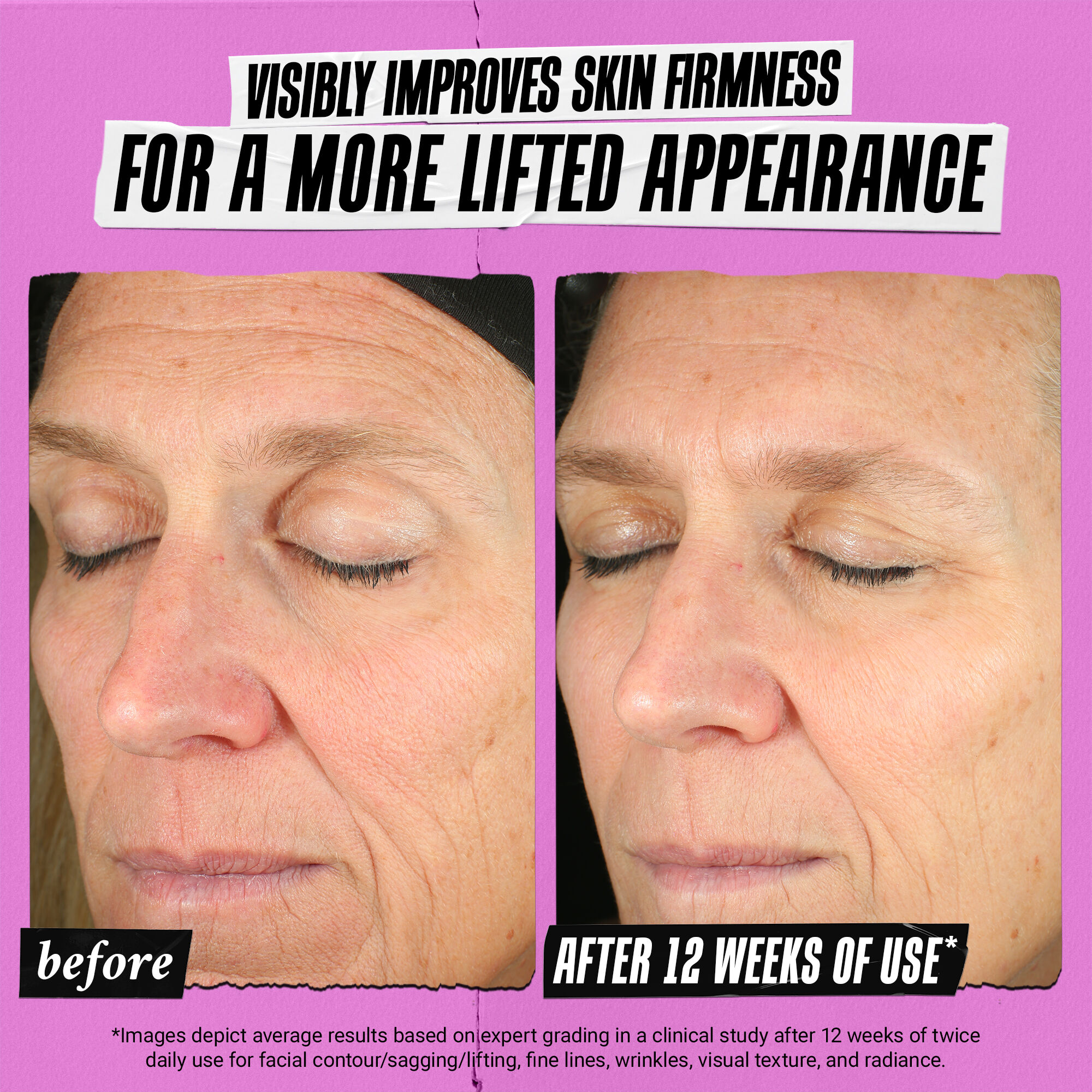 Super Multi-Corrective Anti-Aging Cream for Face and Neck