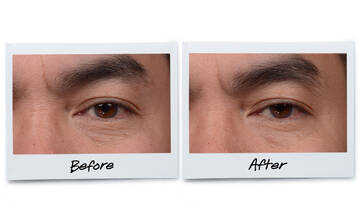 Age Defender Eye Repair