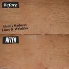 before and after image of forehead. visibly reduces lines & wrinkles