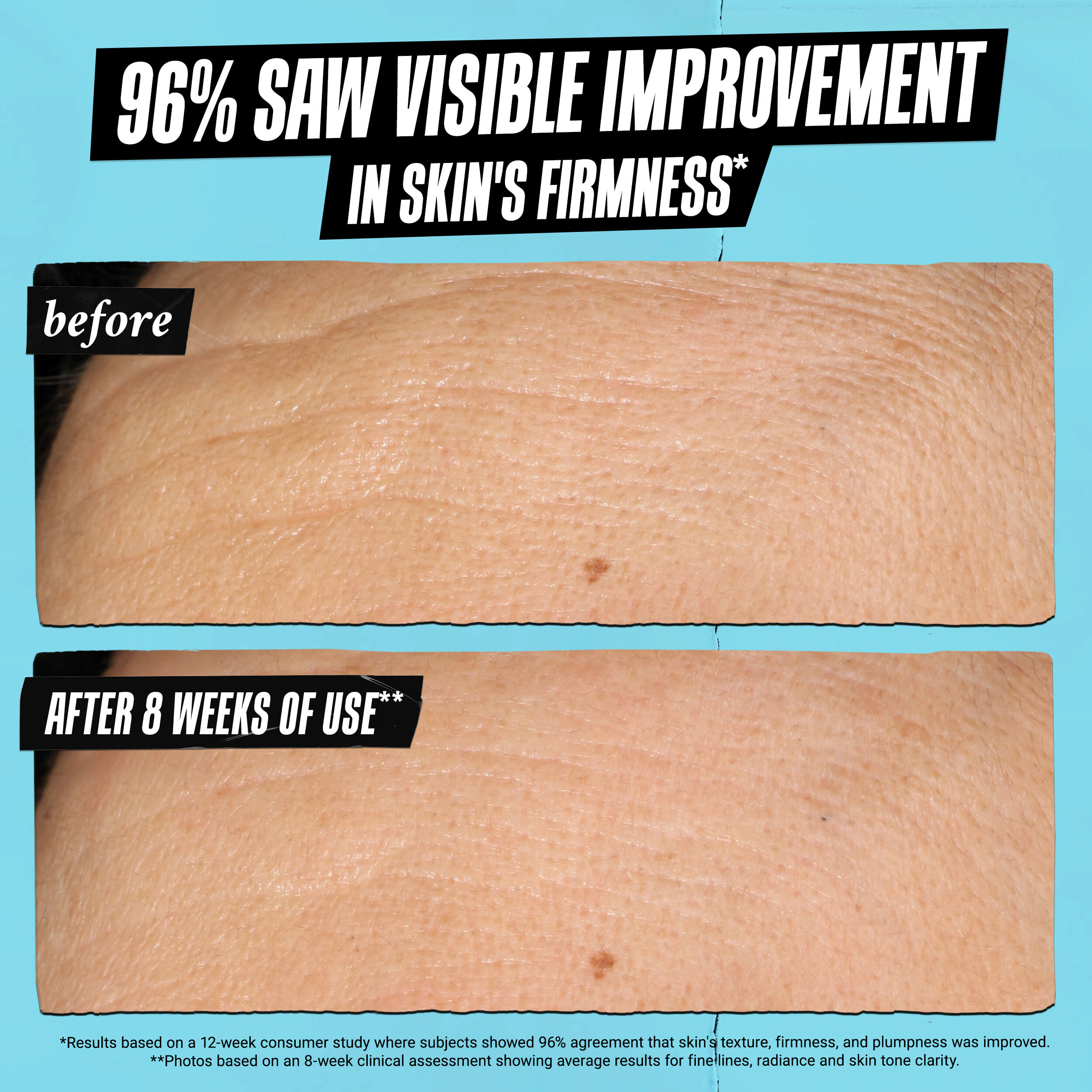 Super Multi-Corrective Soft Cream 