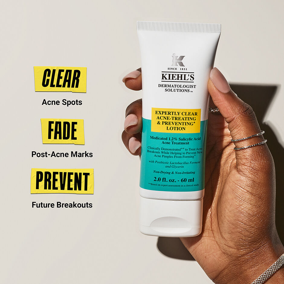 Moisturizers for discount acne prone skin
