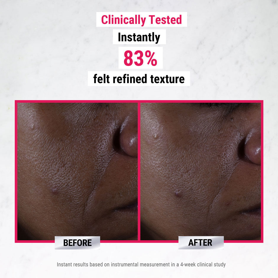 pure-serums-glycolic-acid-before-and-after