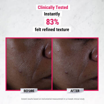 pure-serums-glycolic-acid-before-and-after