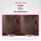 pure-serums-glycolic-acid-before-and-after
