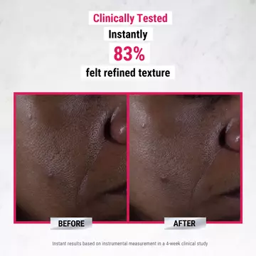 pure-serums-glycolic-acid-before-and-after