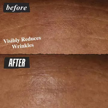 Before and after image of forehead. Visibly Reduces Wrinkles 