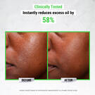 Ultra Pure High-Potency 5.0% Niacinamide Serum