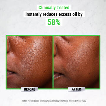 Ultra Pure High-Potency 5.0% Niacinamide Serum