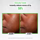Ultra Pure High-Potency 5.0% Niacinamide Serum