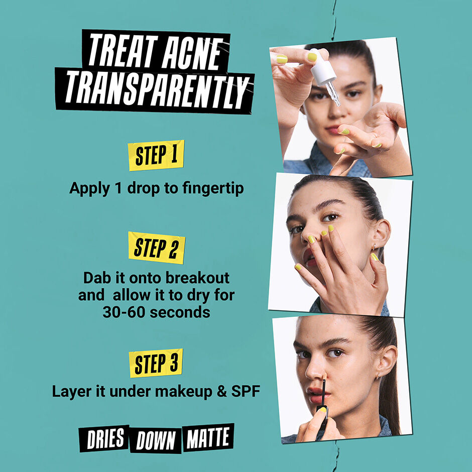 treat acne transparently: step 1- apply 1 drop to finger tip. step 2- dab it onto breakout and allow it to dry for 30-60 seconds. step 3- layer under makeup & spf. Dries down matte