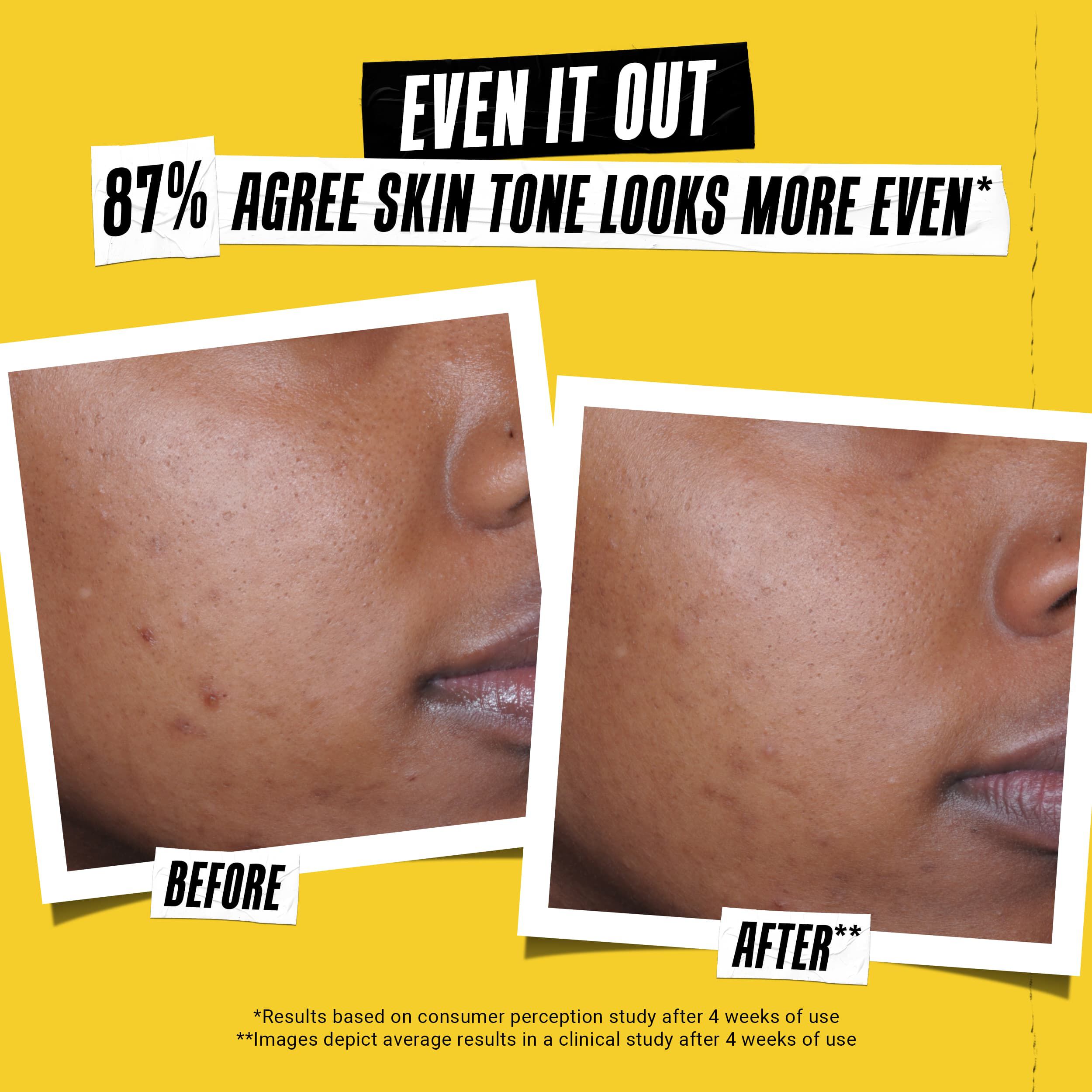 Better Screen™ UV Sunscreen Serum — SPF 50+ Sunscreen — Kiehl's - Main Image