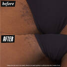 Ingrown Hair and Tone-Correcting Intimate Drops