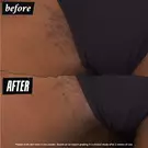 Ingrown Hair and Tone-Correcting Intimate Drops