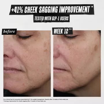 1cc* CollaShot Plumping Serum