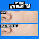 Ultra Pure High-Potency 1.5% Hyaluronic Acid Serum 