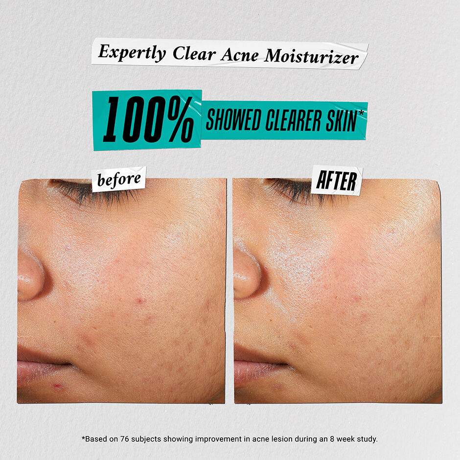 Skincare Solutions Gift Set