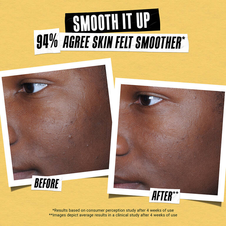 Sunscreen Getting Better Better Screen™ UV Sunscreen Serum — SPF 50+ Sunscreen — Kiehl’s