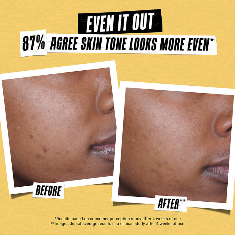 Sunscreen Getting Better Better Screen™ UV Sunscreen Serum — SPF 50+ Sunscreen — Kiehl’s