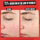 Ultra Facial Medicated Recovery Cream