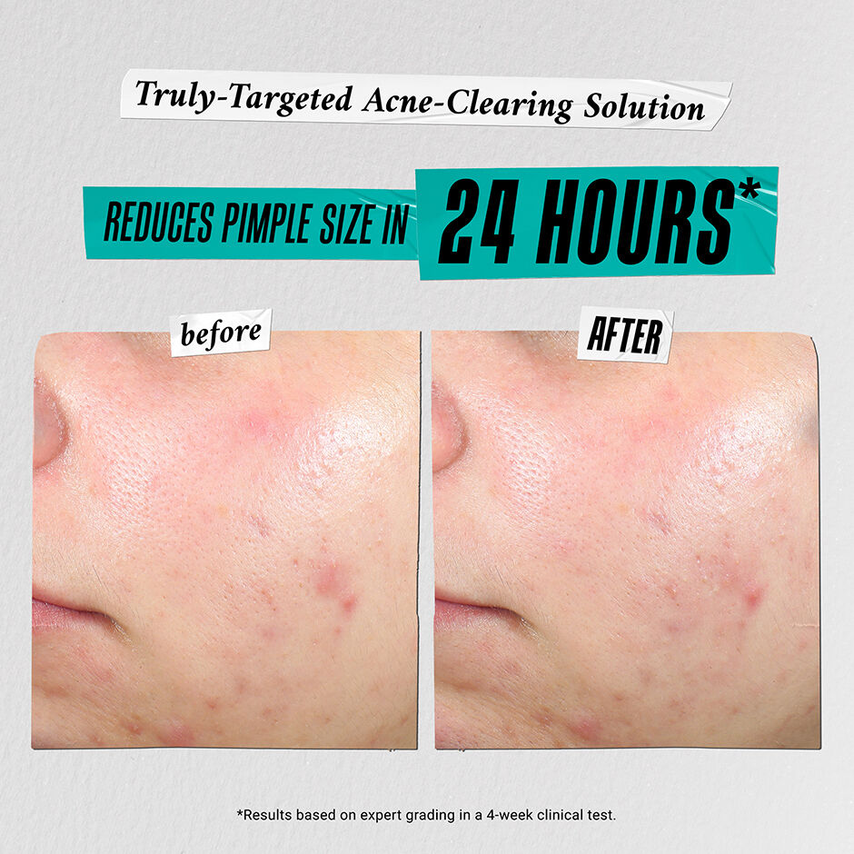 Skincare Solutions Gift Set