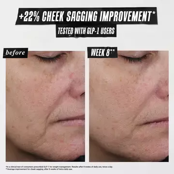 1cc* CollaShot Plumping Serum