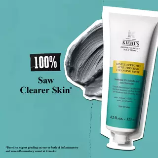 Gently Effective Acne-Treating Cleansing Paste — Gentle Acne Gently Effective Acne-Treating Cleansing Paste — Gentle Acne