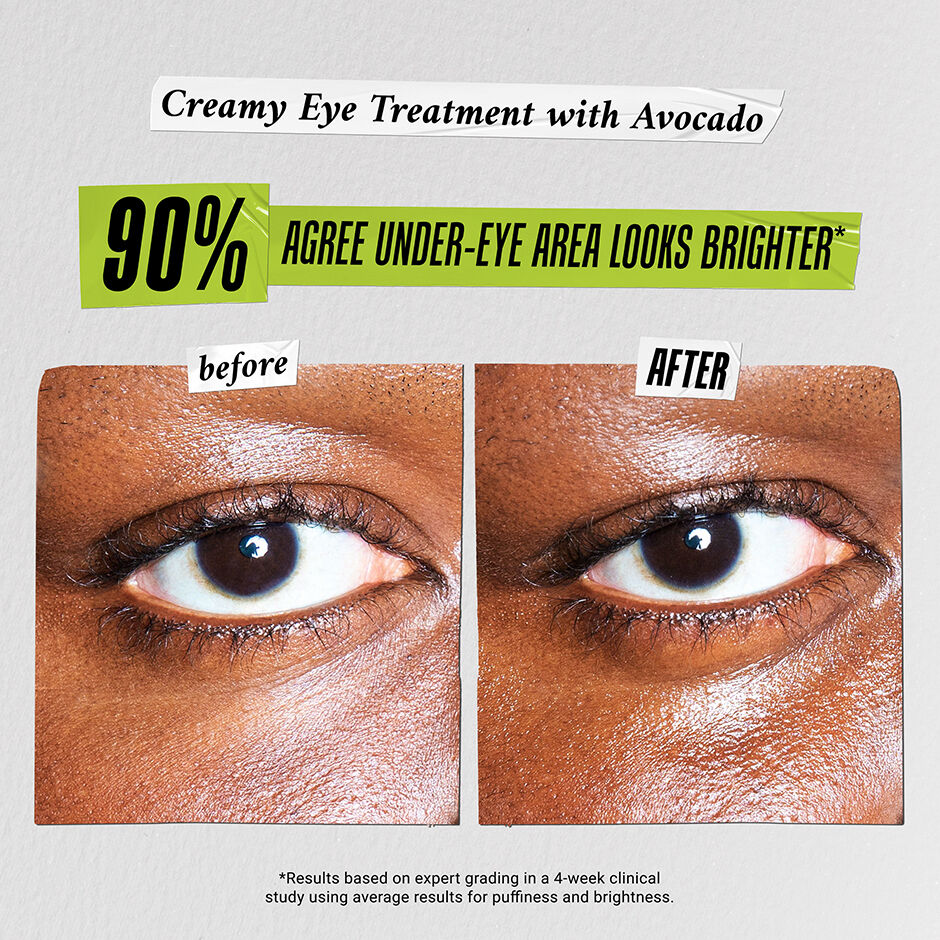 avocado eye cream before and after- 90% afree under eye area looks brighter 