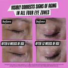 Visibly corrects signs of aging in all four eye zones. before and after of eye lids shown 