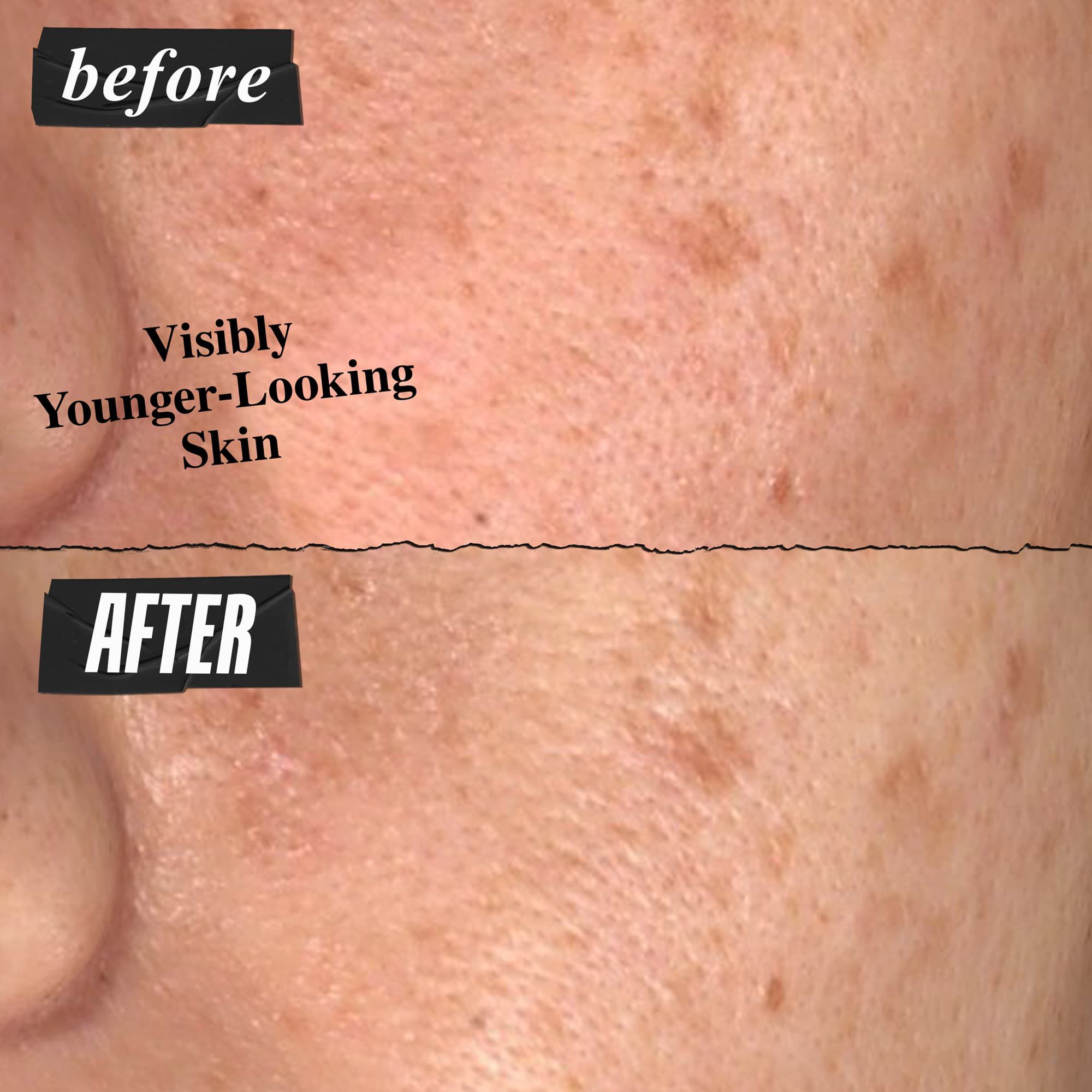 Super Multi-Corrective Anti-Aging Face Cream - Kiehl's