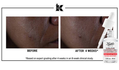 Before and After Glycolic Acid Serum