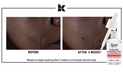 Before and After Glycolic Acid Serum