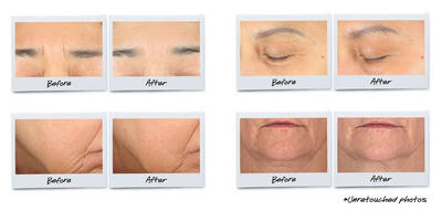 Kiehl's Super Multi Corrective Cream Results