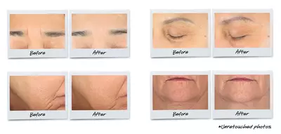 Kiehl's Super Multi Corrective Cream Results