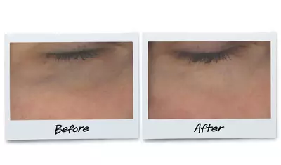 Before and after