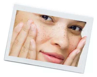 What are Common Characteristics of Sensitive Skin?
