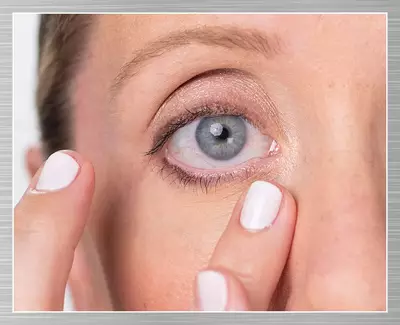 De-puff the Undereye Eye Massage Technique
