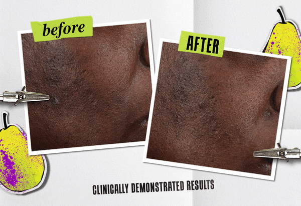 before and after on various skin tones 
